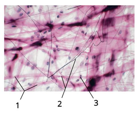 Connective Tissue Flashcards Quizlet