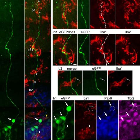 Microglial Cells Intimately Interact With Rg Cells A Egfp Expressing Download Scientific