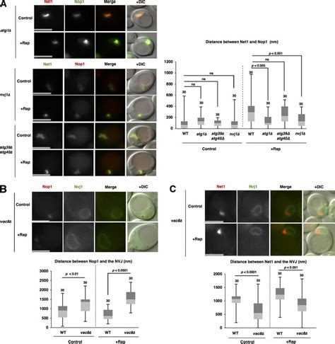 Nucleophagy Is Required For The Repositioning Of Nucleolar Proteins And