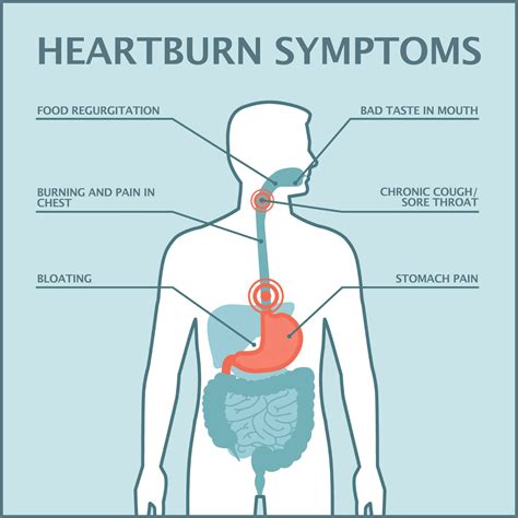 Heartburn Graphics2 1 Gastroenterology Of Greater Orlando