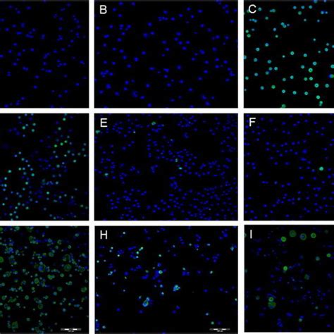 Protein Expression In Corneal Conjunctival And Cultivated Limbal