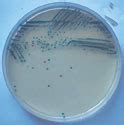 CHROMagar Salmonella Medio de cultivo cromogénico para la detección de