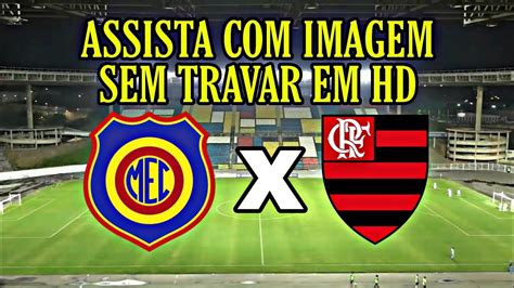 Saiba Onde Assistir Madureira X Flamengo AO VIVO Futemax Futebol