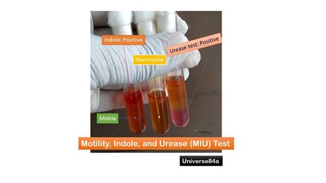 Motility Indole And Urease Miu Test Uses Principle Composition Proc