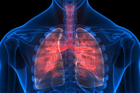 Study Summary: Lung Pilot Study - XACT
