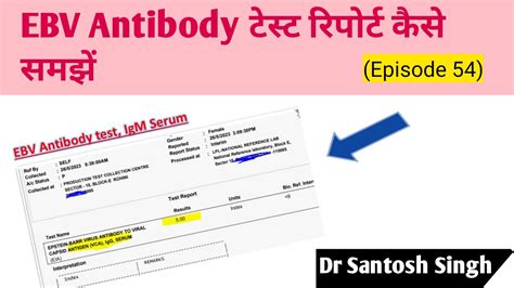 How To Read Ebv Antibody Blood Test Report Ebv Virus Episode 54 Dr