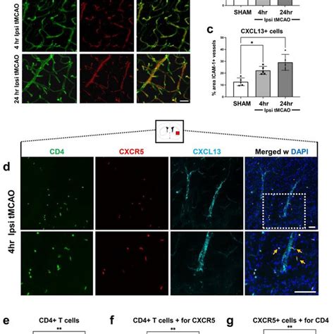 Increased Expression Of Cxcl On Icam Cerebral Blood Vessels Leads