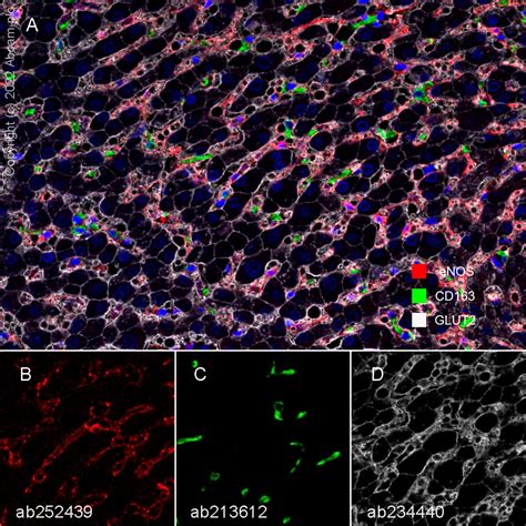 Recombinant Anti Glucose Transporter GLUT2 Antibody EPR22946 74