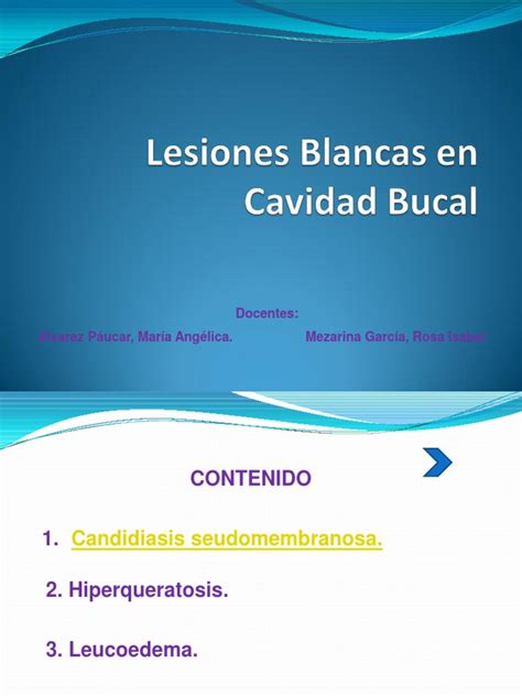 PDF Lesiones Blancas En Cavidad Bucal PDFSLIDE NET