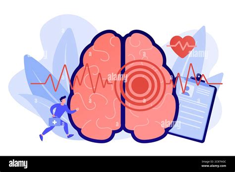 Stroke concept vector illustration Stock Vector Image & Art - Alamy