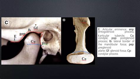 Temporo Mandibular Joint Anatomy Ppt