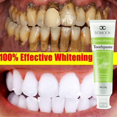 Teeth Whitening Toothpaste Tartar Removal For Teeth 120g Probiotics