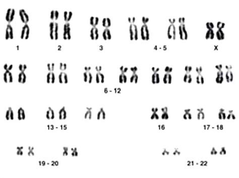 Y Chromosome The Definitive Guide Biology Dictionary