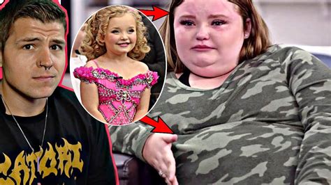 Honey Boo Boo Had Weight Loss Surgery The Easy Way YouTube