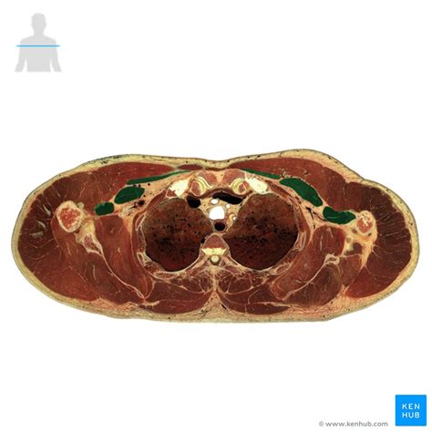 Definition And Importance Of Cross Sectional Anatomy Kenhub