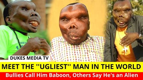 Meet Sebabi The Ugliest Man In The World Born Different Youtube