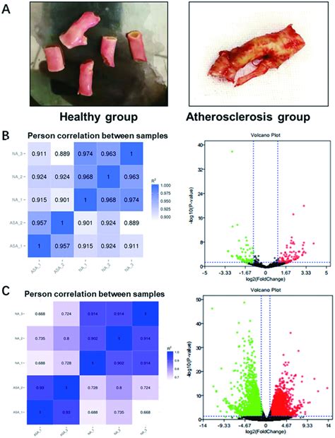 Adipose Derived Mesenchymal Stem Cells Derived Exosome Mediated