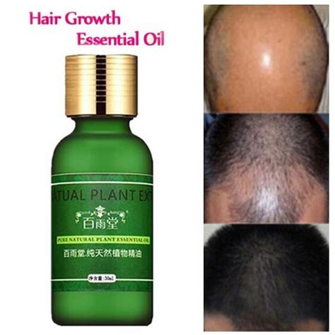 Hair Care Hair Growth Essential Oils Essence Original Authentic 100 Hair Loss Liquid Health