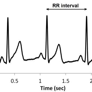 Density Of Detrended RR Intervals Plotted Against The RR Interval Value