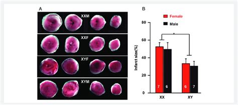 Larger Ex Vivo Myocardial Infarct Size In Gdx Fcg Xx Mice Compared With