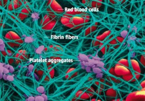 Bleeding Disorders And Coagulation Cascade Flashcards Quizlet