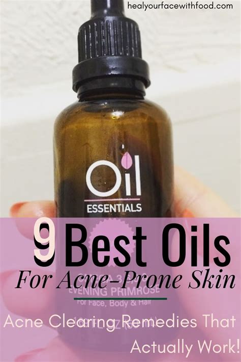 Best Oils For Acne Prone Skin