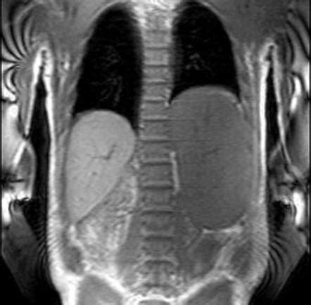 Radiology Quiz Radiopaedia Org