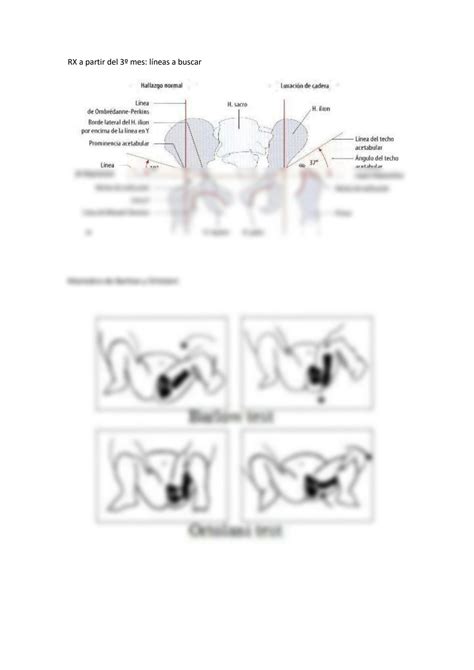 SOLUTION: Displasia rx barlow y ortolani - Studypool