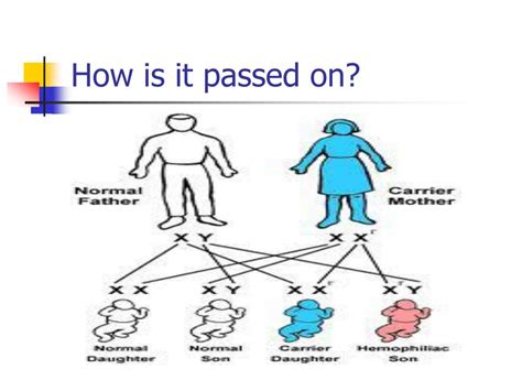 Ppt Hemophilia The Royal Disease Powerpoint Presentation Free