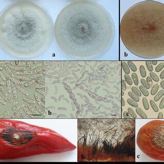 Colletotrichum Gloeosporioides Group A Colony Morphology Of C