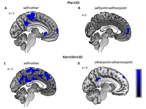 Lsd Blurs The Line Between Our Own Sense Of Self And Others