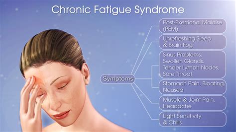 Chronic Fatigue Syndrome Shown And Explained Using A Medical Animation