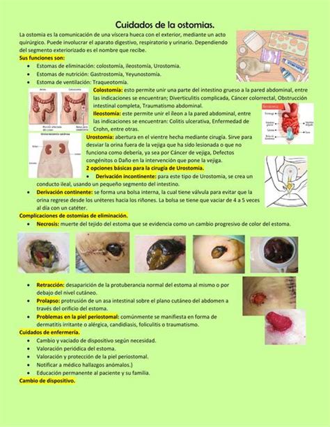 resumen Cuidados de la ostomias Jennifer De Los Ángeles Villegas