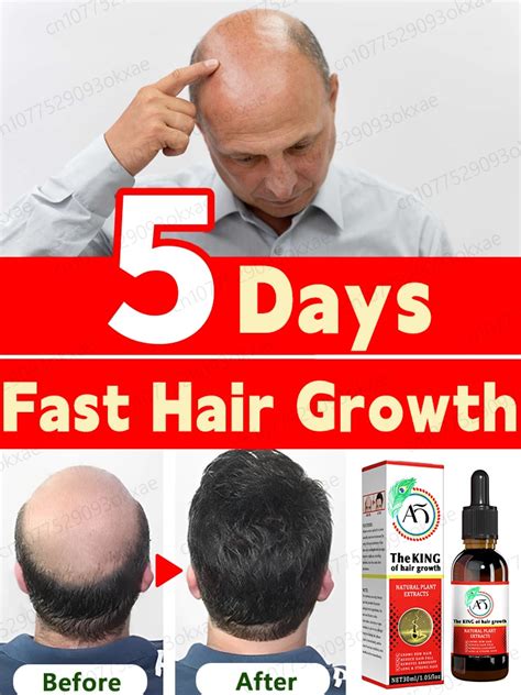 Hair Growth Oil Fast Hair Growth Effective Treatment For Baldness