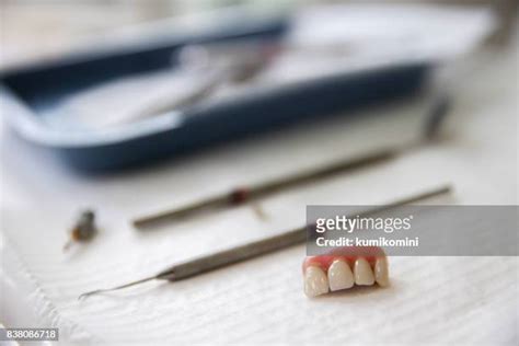 Loose Tooth Adult Photos And Premium High Res Pictures Getty Images