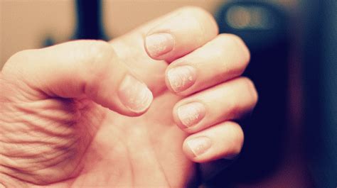 3 Home Remedies For Dry Cuticles Nail Designs