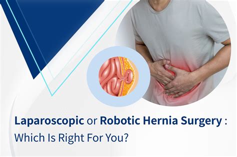 Laparoscopic Vs Robotic Hernia Surgery Key Differences