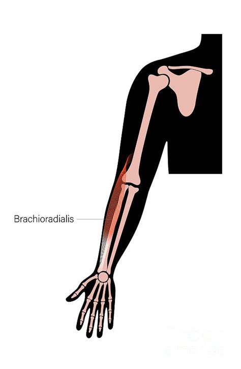 Brachioradialis Muscle Anatomy Photograph By Pikovit Science Photo