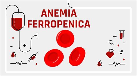 Anemia Udocz