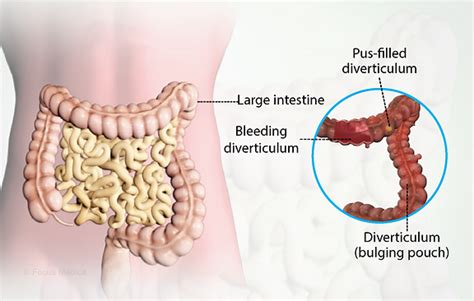 Health Symptoms : Causes, Treatment, Conditions and More