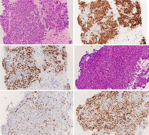 Figure3 An Immunohistological Analysis Identified The Anterior