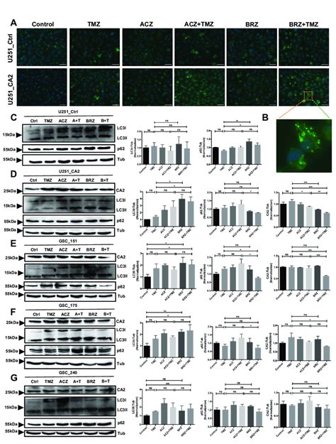 The Combination Of Brz And Tmz Increased Cell Death In Gbm Stem Like Download Scientific