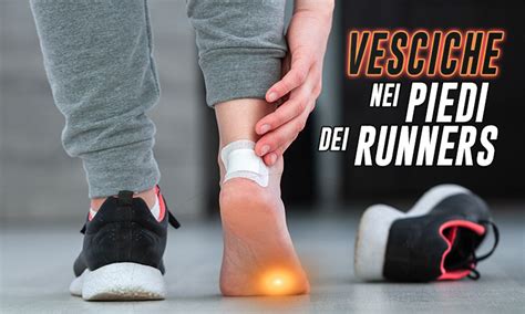 Come Curare Le Vesciche Ai Piedi Perch Insorgono E Come Prevenirle