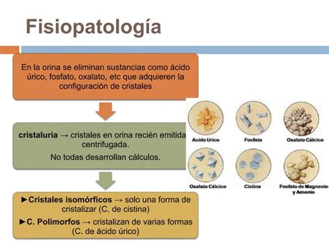 Litiasis Urinaria Ppt Descarga Gratuita