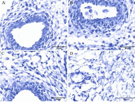 Negative Control Of Ihc A Negative Control For Cd34 B Negative Download Scientific