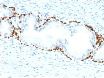 Anti P63 Squamous Basal Myoepithelial Cell Marker Monoclonal