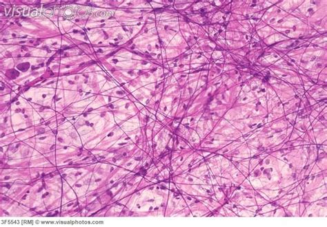 Areolar Connective Tissue Slide