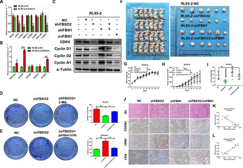 Frontiers Fbxo2 Promotes Proliferation Of Endometrial Cancer By