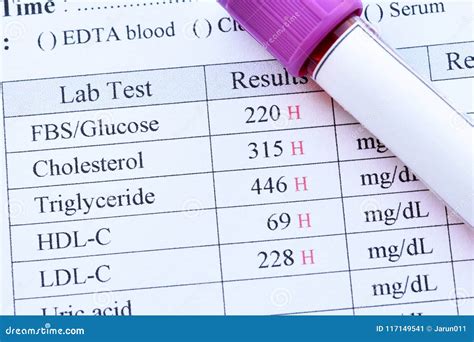 Abnormal High Results Of Lipid Profile And Blood Sugar Test Stock Image