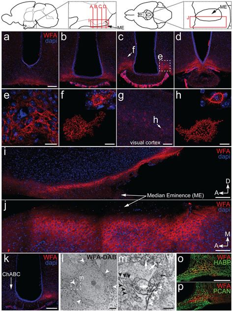 Wisteria Floribunda Agglutinin WFA Labeling In The Ventromedial ARC